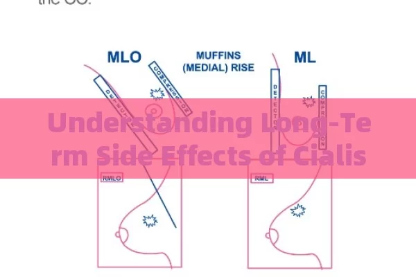 Understanding Long-Term Side Effects of Cialis: What You Need to Know